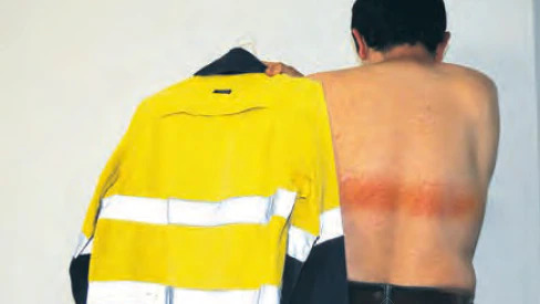 How to Prevent Burns From Wearing High Visibility Clothing